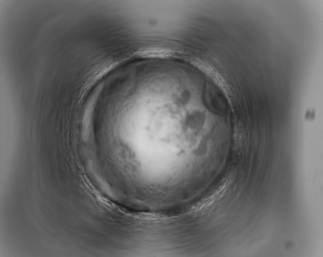 X0000098150529200804171615