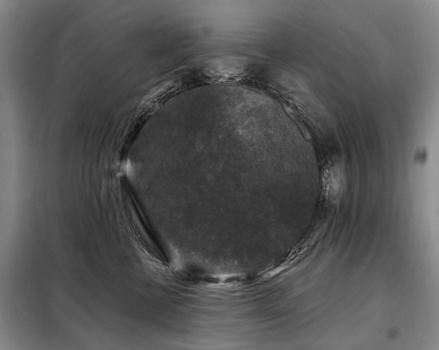 X0000098150570200804171615
