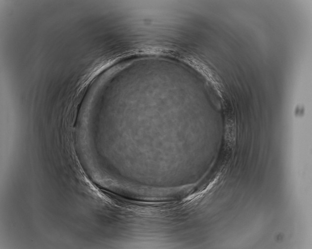 X0000098150577200804171615