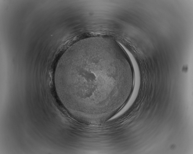 X0000098150699200804171613