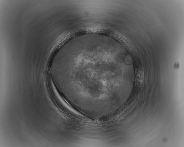 X0000098150738200804171612