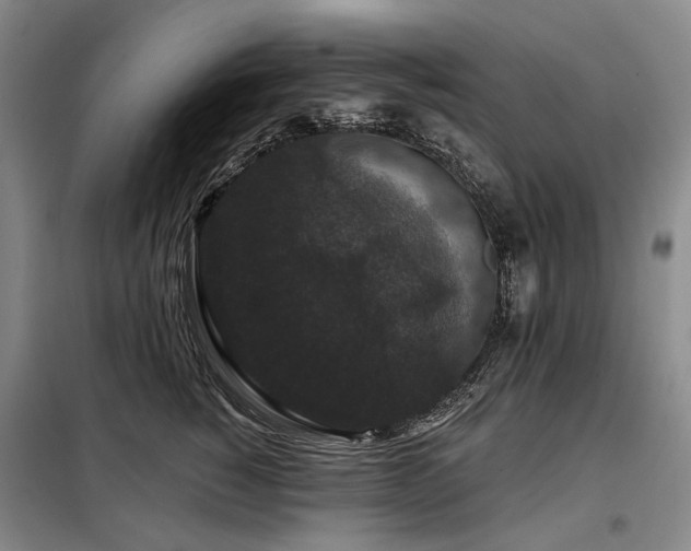 X0000098150760200804171613