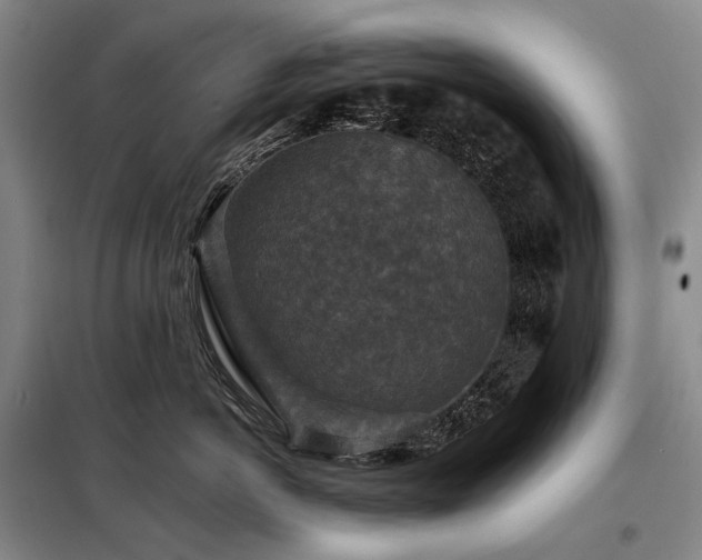 X0000098150766200804171613