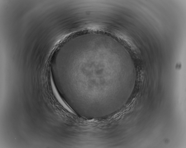 X0000098150776200804171612