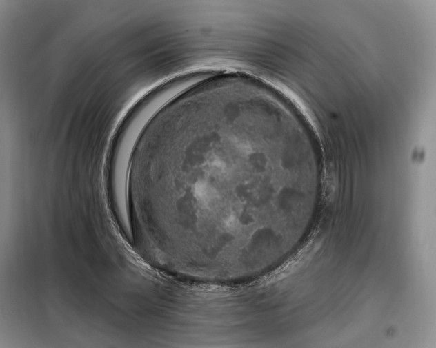 X0000098150783200804171612