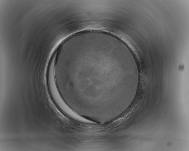 X0000098150791200804171612