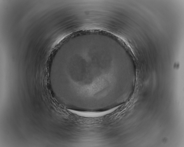 X0000098150871200804171610