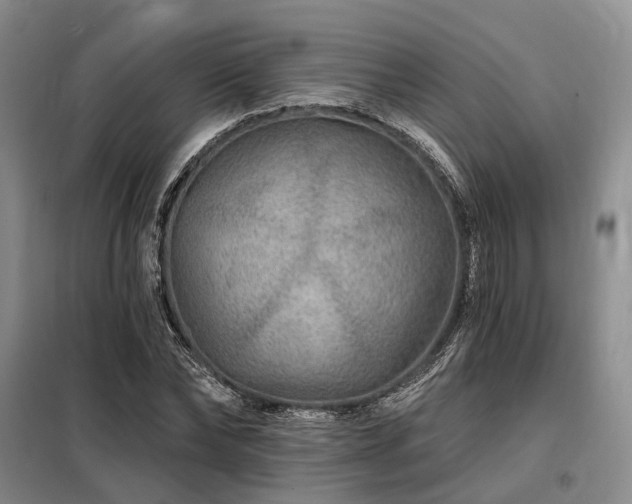 X0000098150878200804171610