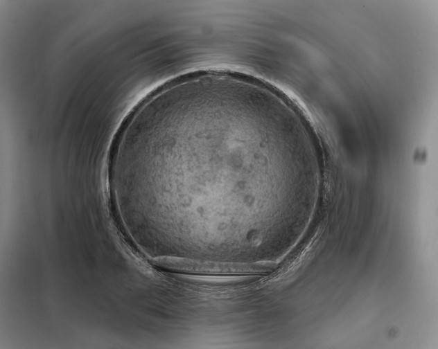 X0000098150887200804171610