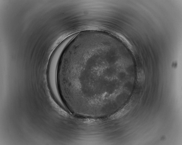 X0000098150938200804171609
