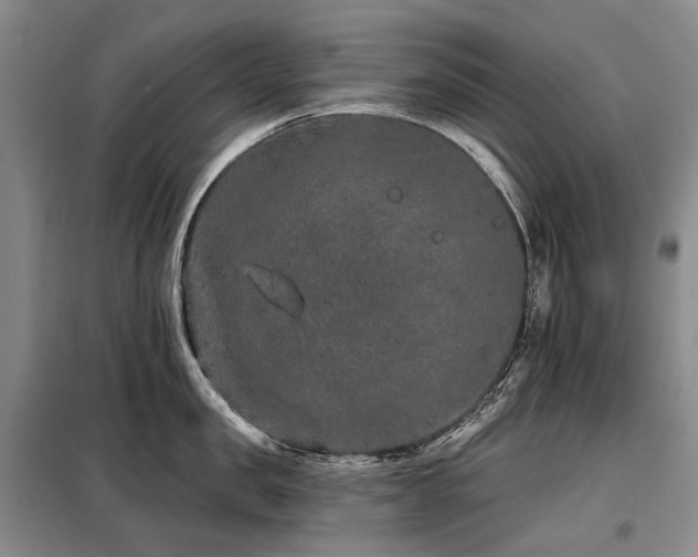 X0000098150957200804171610