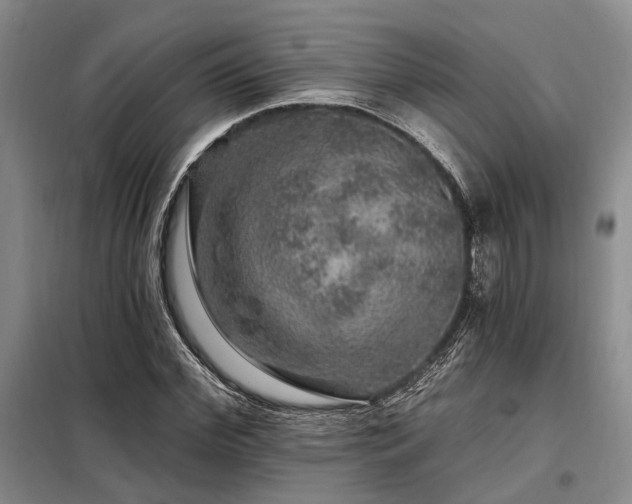 X0000098150972200804171609