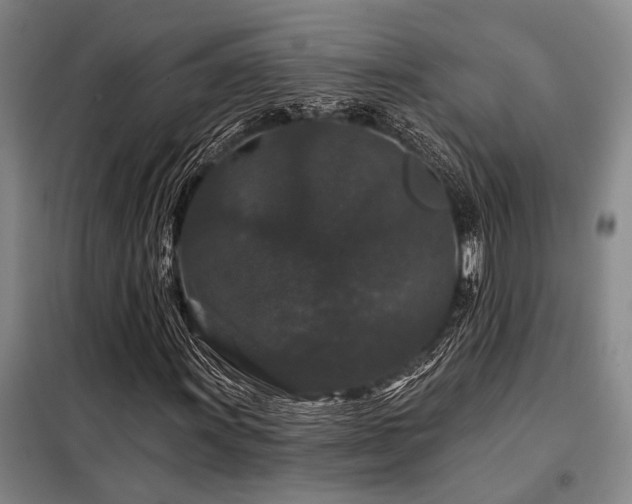 X0000098151011200804171607