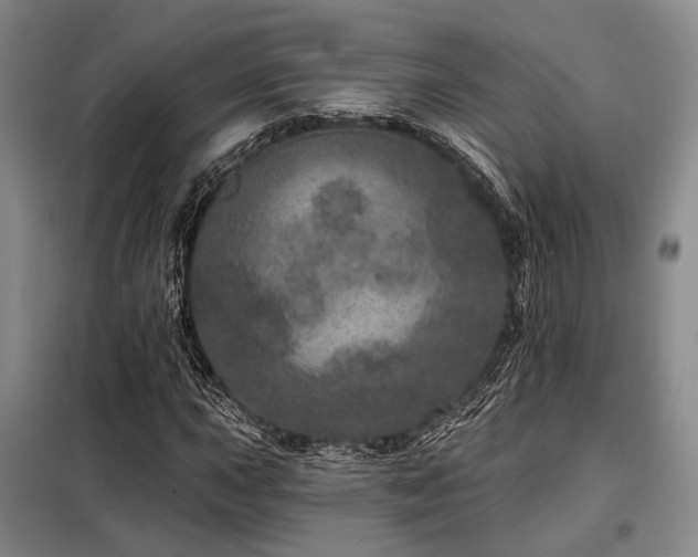 X0000098151015200804171607