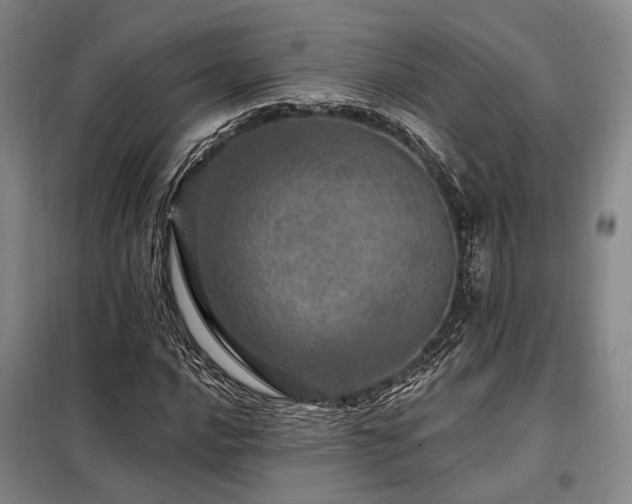 X0000098151016200804171607