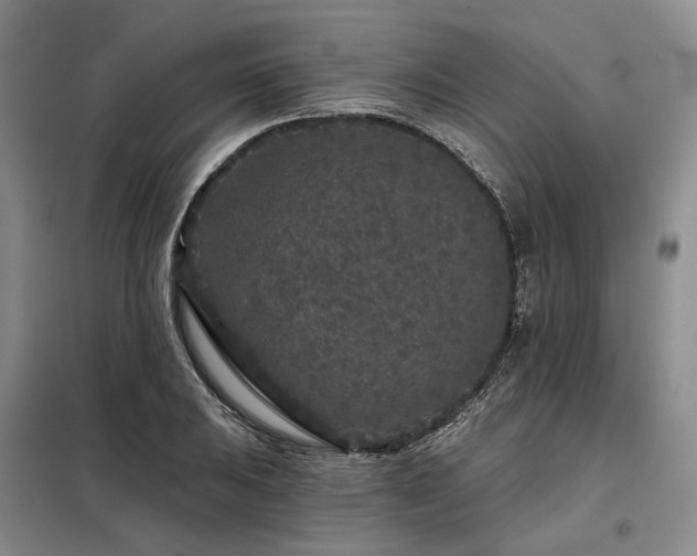 X0000098151031200804171608