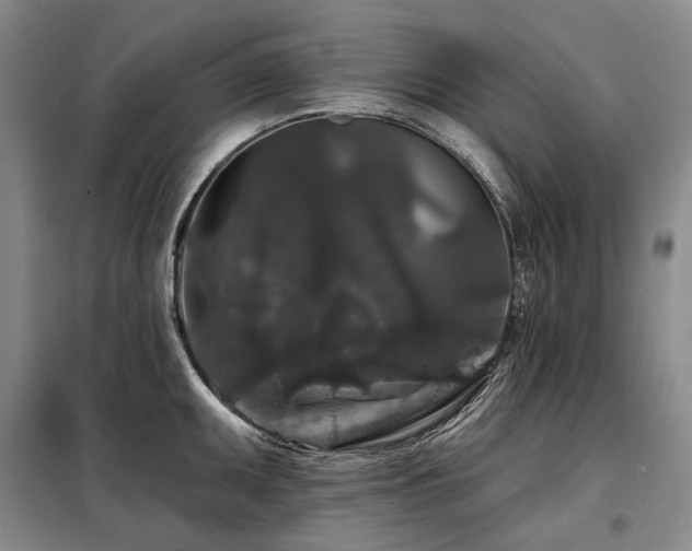 X0000098151095200804171607