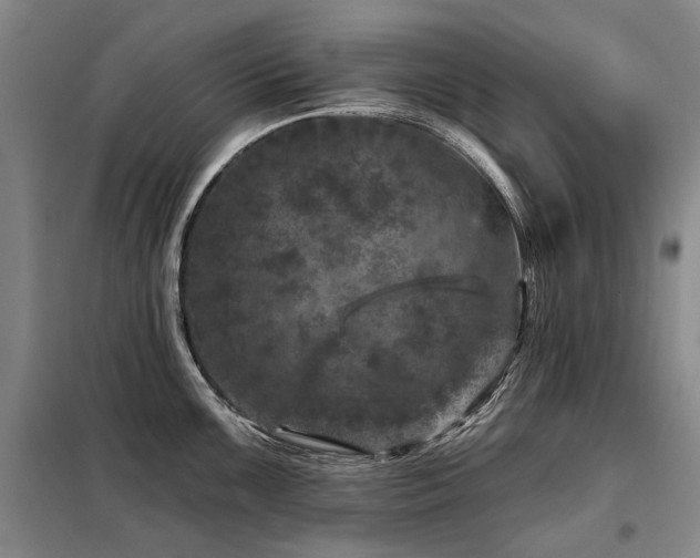 X0000098151099200804171607