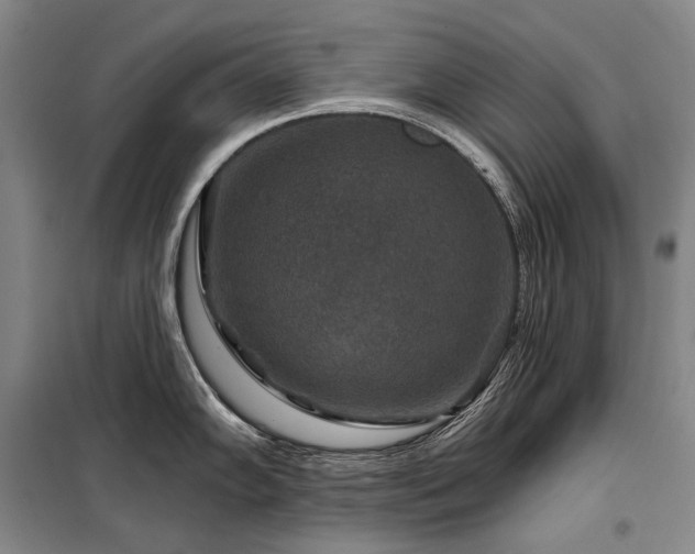 X0000098151102200804171607