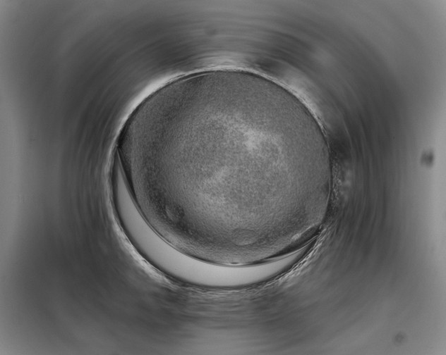 X0000098151142200804171606