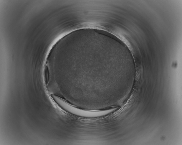 X0000098151144200804171606