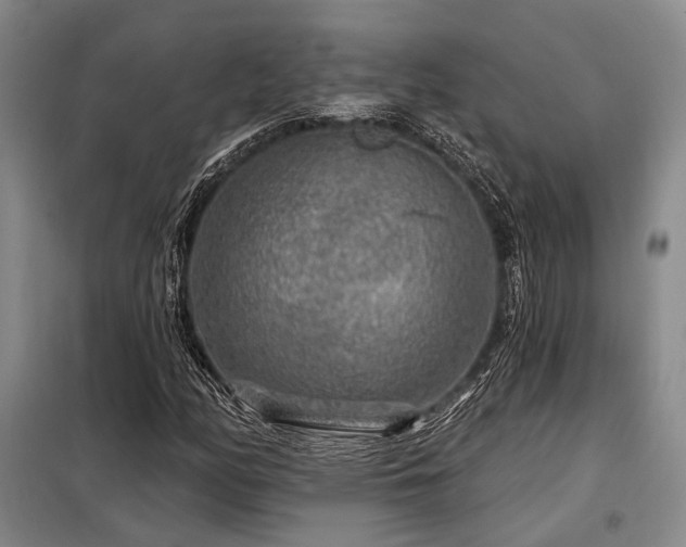 X0000098151158200804171605