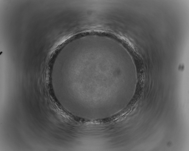 X0000098151159200804171605