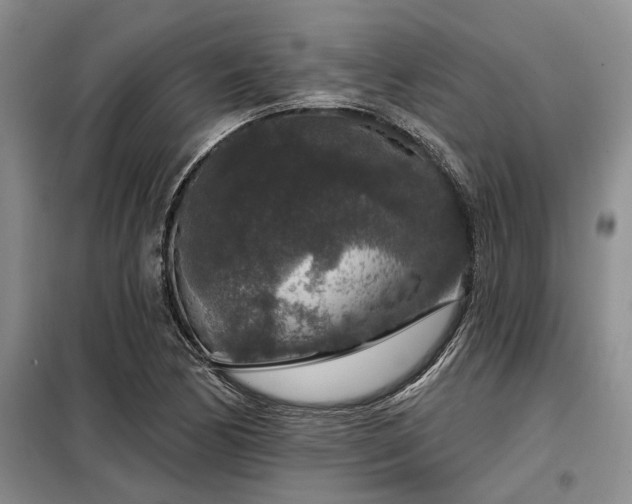 X0000098151170200804171605