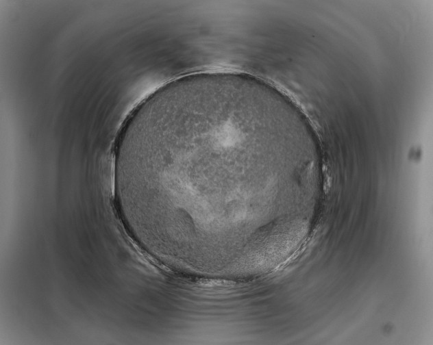 X0000098151171200804171605