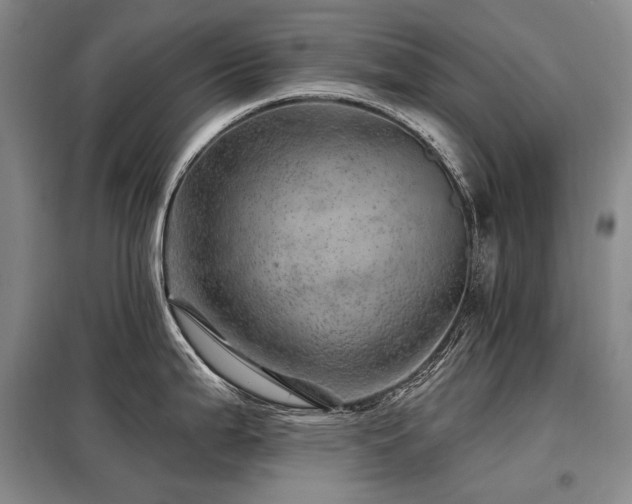 X0000098151199200804171605
