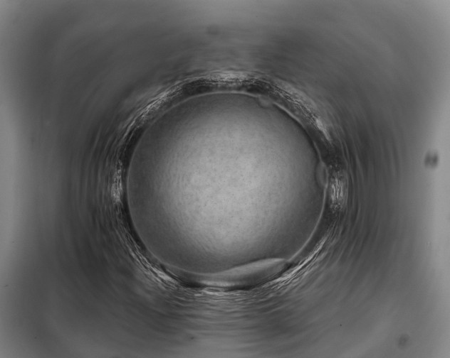 X0000098151204200804171604