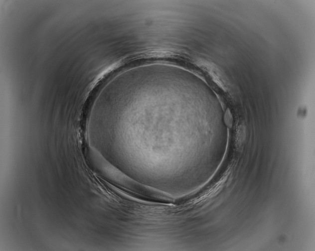 X0000098151210200804171604