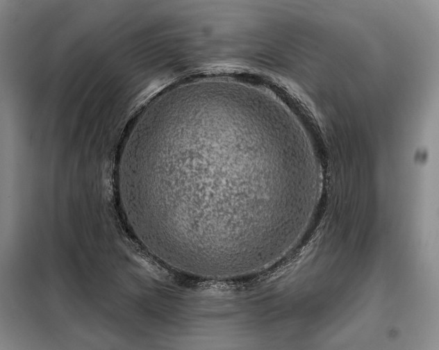 X0000098151217200804171604
