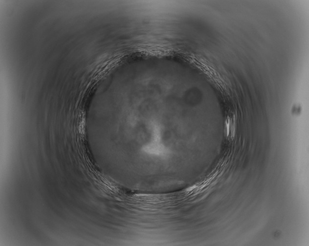 X0000098151251200804171604