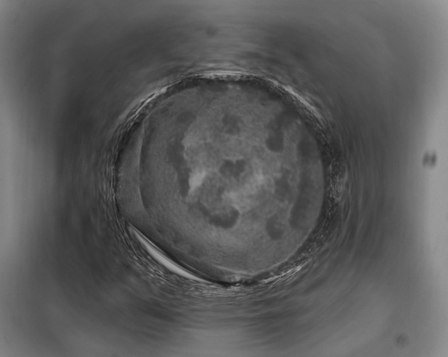 X0000098151351200804171602