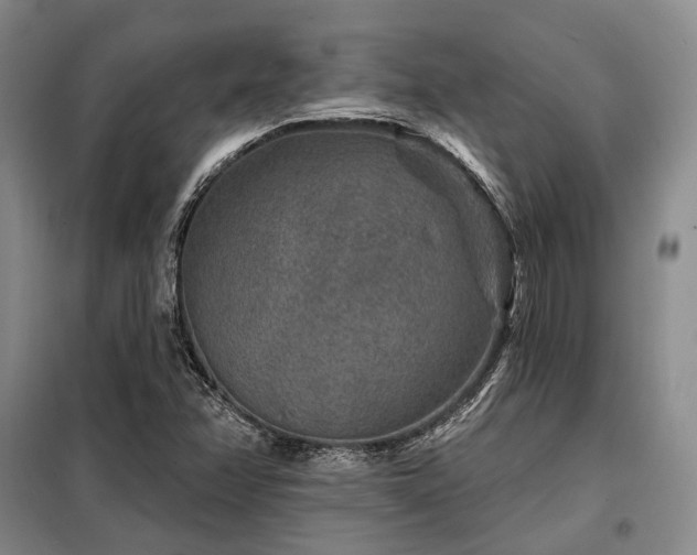 X0000098151358200804171602