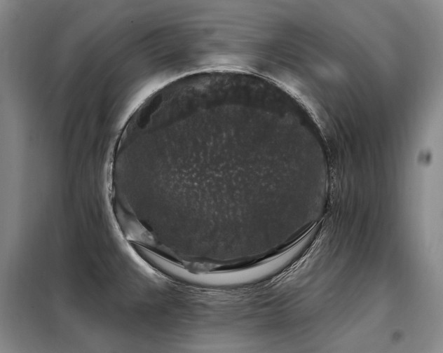 X0000098151383200804171602