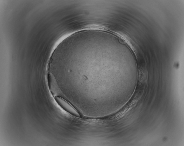 X0000098151387200804171602