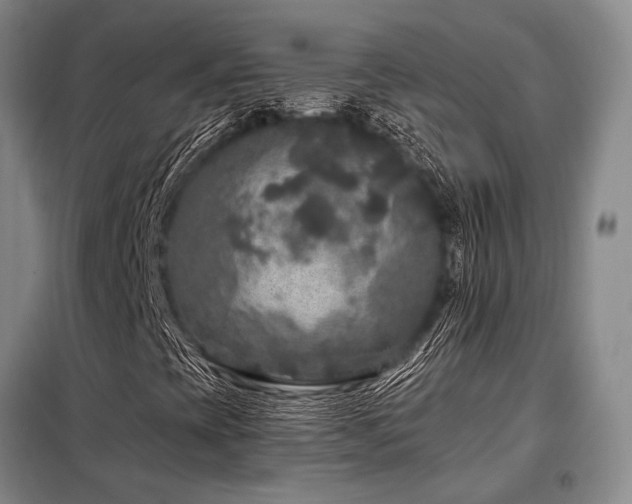 X0000098151393200804171601