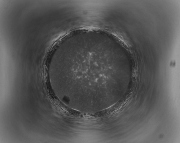 X0000098151398200804171601