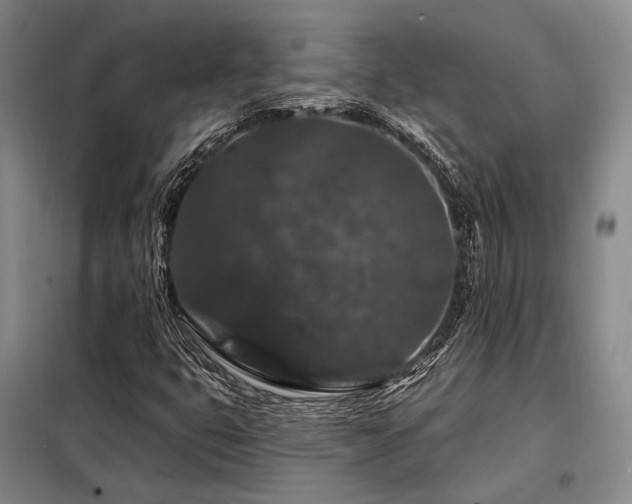 X0000098151399200804171601