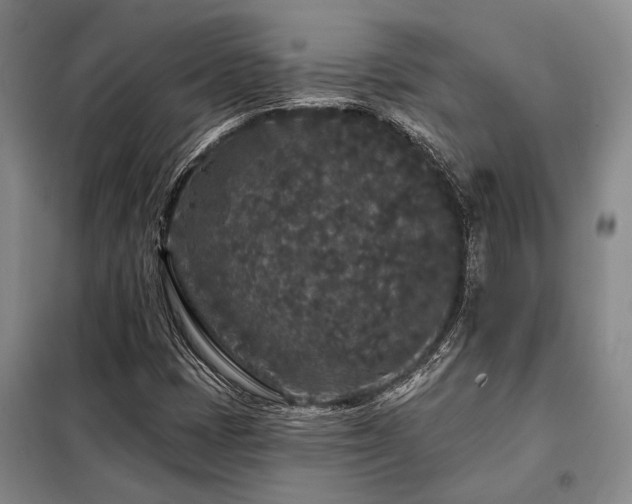 X0000098151401200804171601