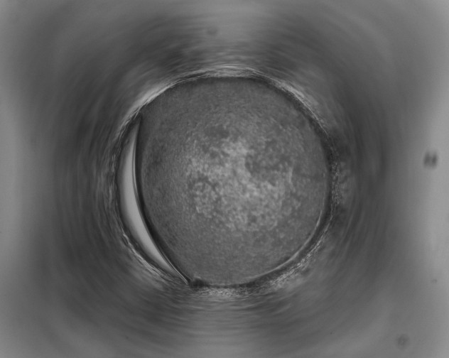 X0000098151402200804171601