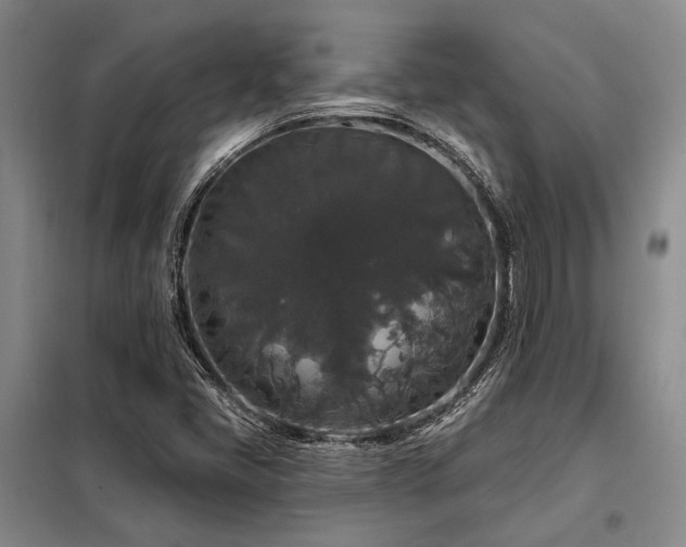 X0000098151405200804171601