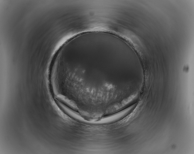 X0000098151422200804171601