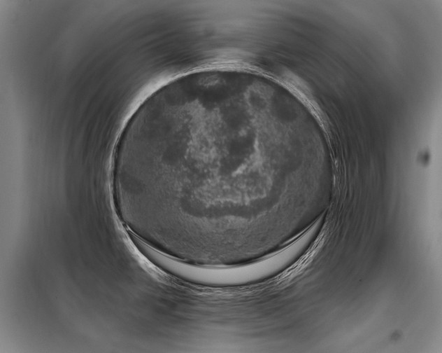X0000098151438200804171601