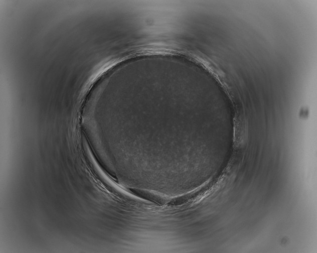 X0000098151453200804171601