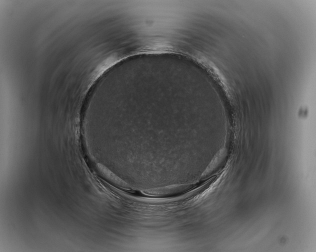 X0000098151457200804171601