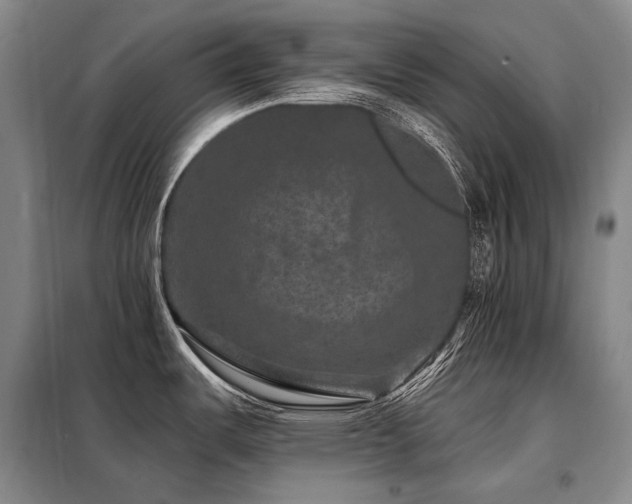 X0000098151487200804171600