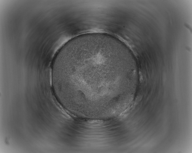 X0000098151171200804241732